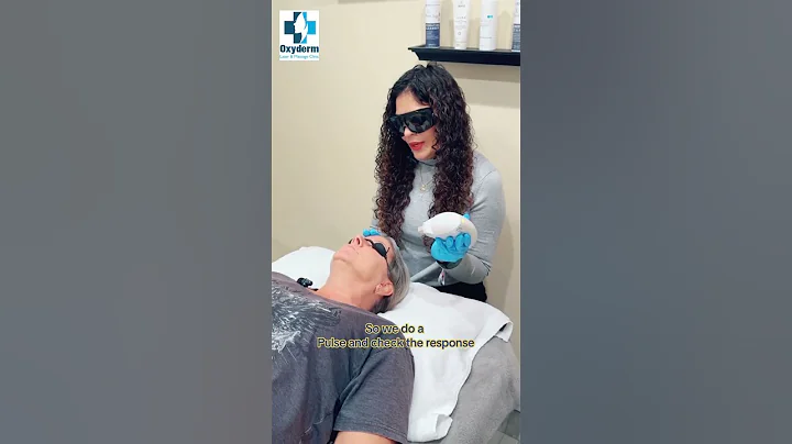 🌟 Transform Your Skin with Rosacea Laser Treatment at Oxyderm Laser clinic!🌟