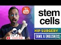 Stem cell augmented hybrid HIP Replacement-Dr Santhosh Jacob