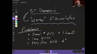 The historical context of STEMI and OMI