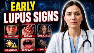 11 LUPUS Symptoms You Should Never Ignore (Early Signs)