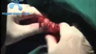 Medical Scam Pusat Rawatan Keraton Updated