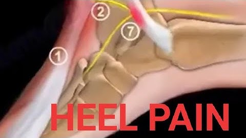 HEEL pain and it