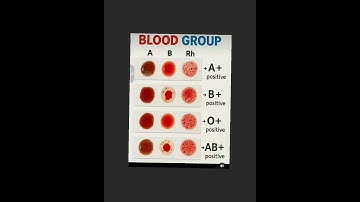 #new #video #neet best pyqs #your blood group #best  video learning blood group