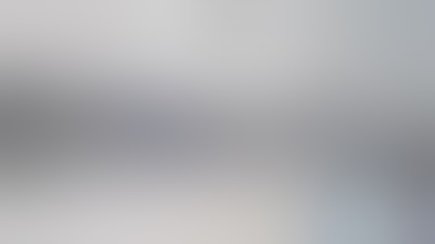 Fracture both the bones forearm : PAEDIATRIC | Displaced and radial Fracture overriding | ORIF | AHV