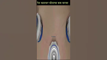 प ट क टकर म ट प कम करन प ट क चर ब 10 द न म म ट प क स कम कर Shorts 