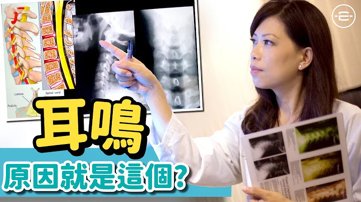 脊医王凤恩- 耳鸣 原因就是这个? What is the cause of Tinnitus? Dr. Matty Wong Doctor of Chiropractic - 天天要闻