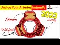 ❤️ 3 Clinically Proven Ways To Unclog & Clean Your Arteries, Naturally In 2023 - by Dr Sam Robbi