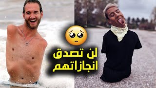 أشخاص بدون أطراف تحدوا الاعاقة وصدموا العالم بانجازاتهم !! حتما ستبكي