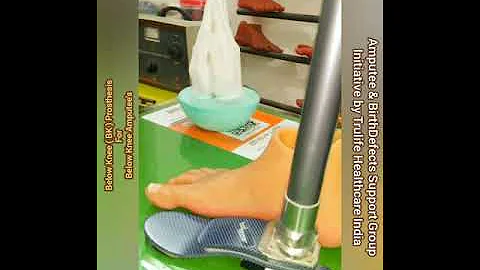 Artificial Limbs in Delhi : Best  Below Knee  Prosthesis India | Silicone Foot Delhi, Silicone Toe