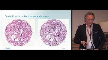 ECDP 2019 | Challenges in the development of deep learning algorithms for pathology