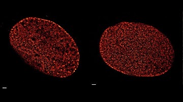 Single molecule localization microscopy (SMLM) time-lapse series of human fibroblast nucleus