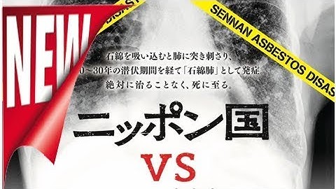 原一男「ニッポン国VS泉南石綿村」8年にわたる闘い捉えた予告解禁 - 映画ナタリー[ニュース]