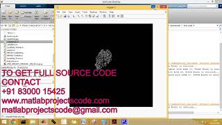 Matlab code for Detecting Subsurface Circular Objects from Low Contrast Noisy Images: Applications