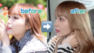 整形疑惑について。