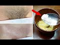 Stop shaving! Here&#39;s how to permanently get rid of unwanted hair . facial and body hair.