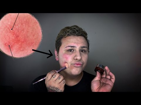 Hiding My Insecurities || IT Cosmetics (Bye Bye Redness)-thumbnail