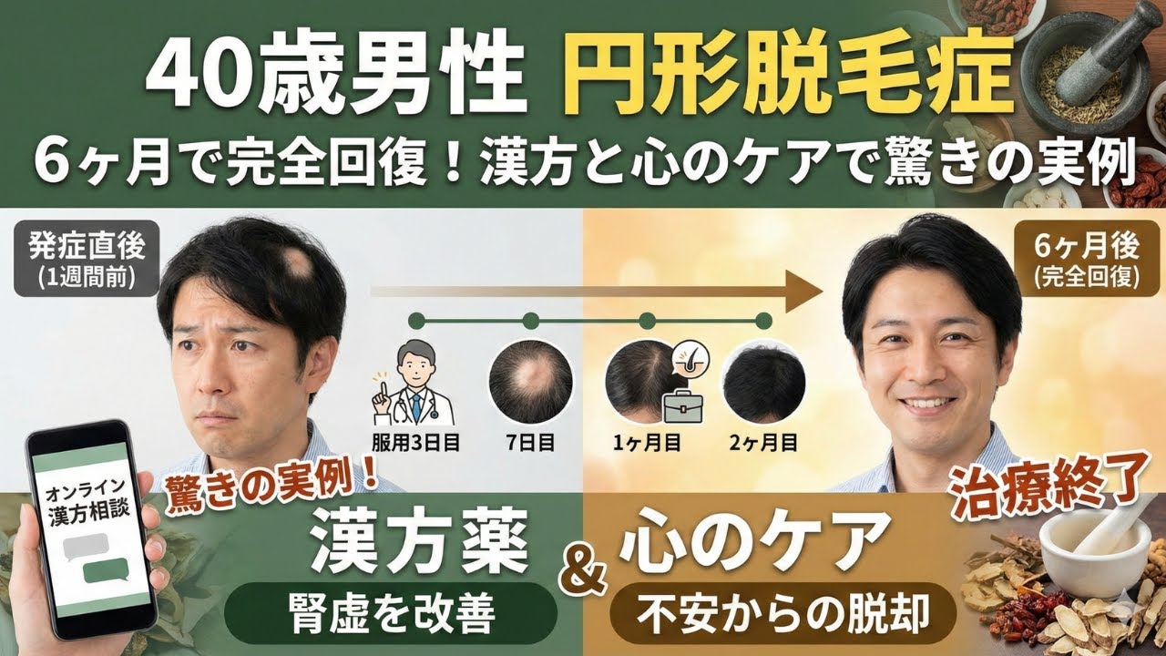 「漢方薬由来のRQ-001、脱毛症治療で28％の効果 臨床試験で毛髪密度向上」