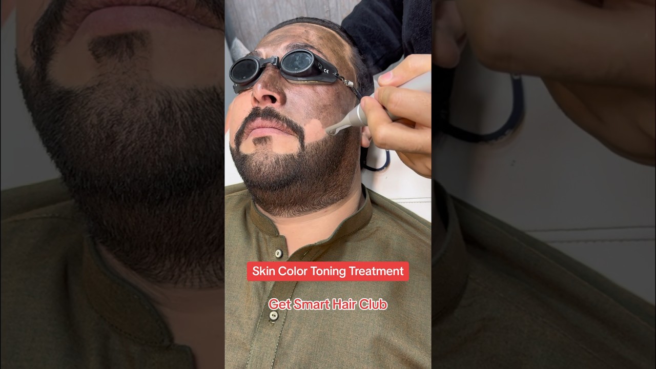 Skin Color Toning Treatment 