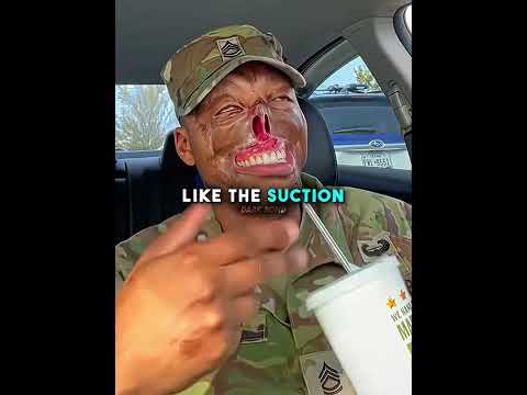 He Survived The Massive Bomb Explosion