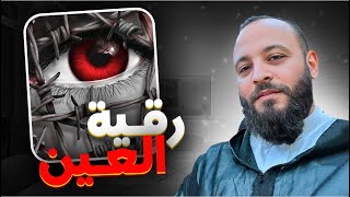 من اعراض العين و الحسد موضوع مهم