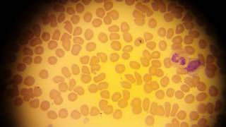 КЛЕТКИ КРОВИ под микроскопом!  BLOOD CELLS under the microscope!