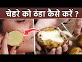 Cool Face Pack For Summer: Chehre Ko Thanda Kaise Kare | चेहरे को ठंडा कैसे करें | Boldsky