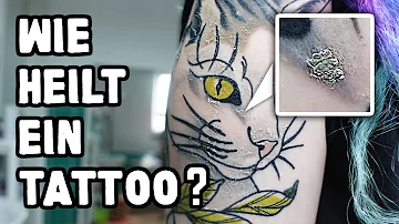 Was kann man gegen vernarbte Tattoos machen?