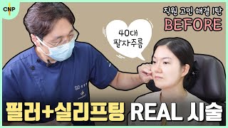 필러와 실리프팅으로 40대 팔자주름 시술과정 대공개! [직원 고민해결 1탄]