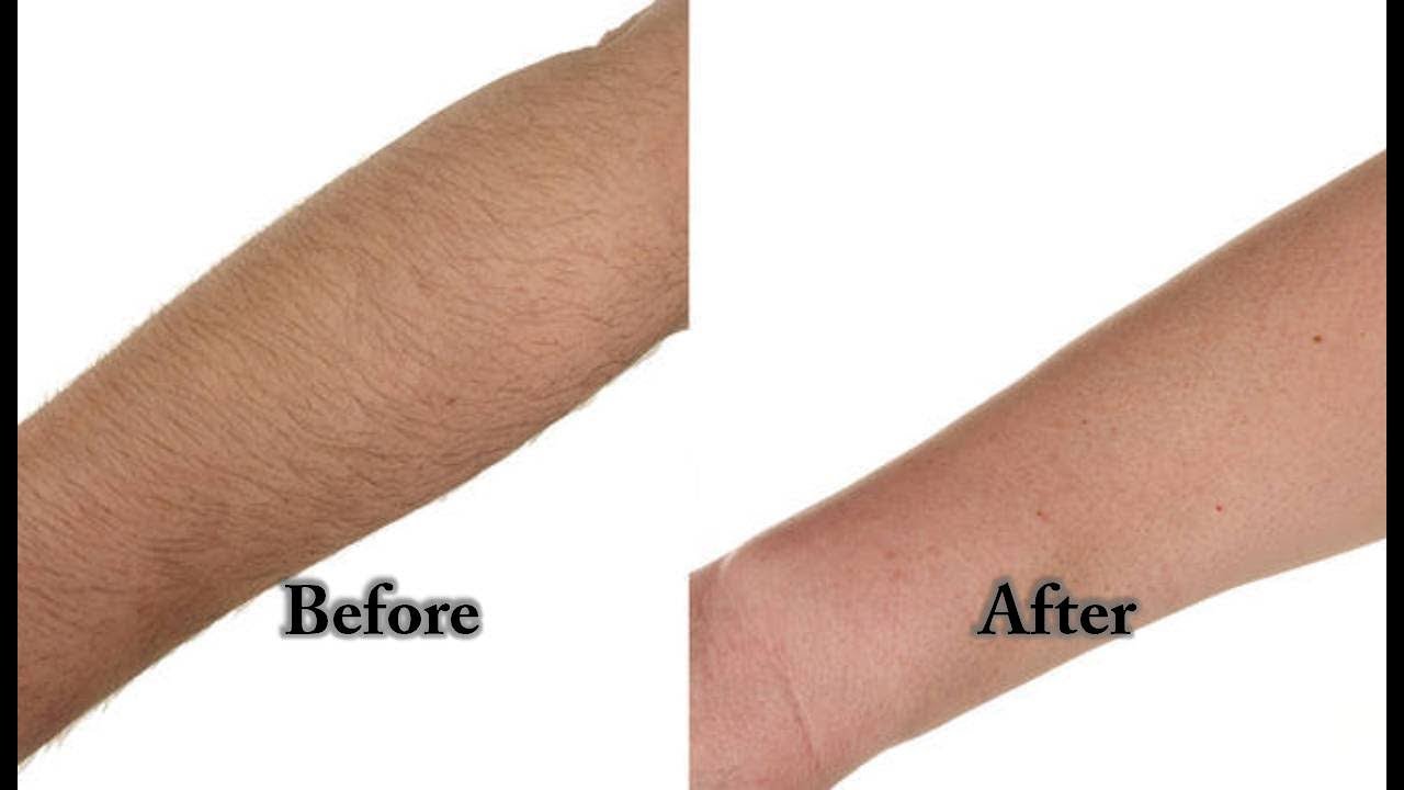 Remove Unwanted Hair without Pain How to Remove Unwanted Hair