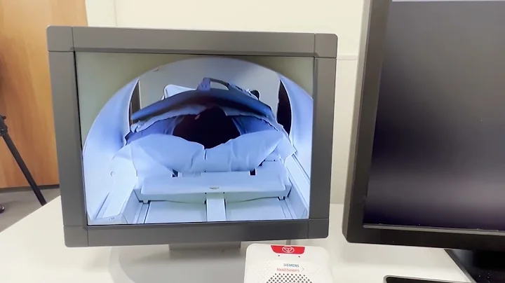 CAN AI PREDICT HEART ATTACKS?