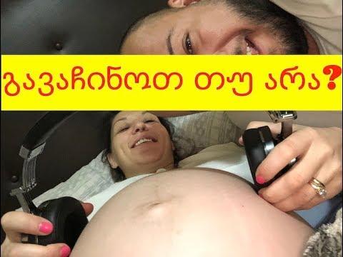 ვიდეო: კატის ორსულობა და მშობიარობა - ნიშნები, კატის ორსულობის სიგრძე და სხვა