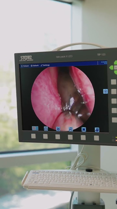 WHAT IS THAT?! #ent #entsurgery #hearingloss #nasalcongestion #sinusinfection #sinusitis #nose