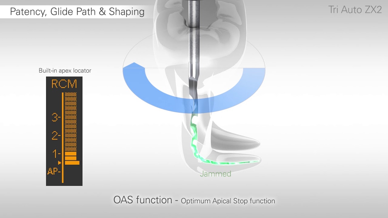 TriAuto ZX2 - Функция оптимальной апикальной остановки - OAS