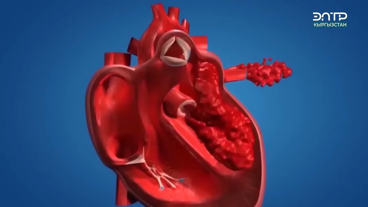 ЖҮРӨККӨ УНИКАЛДУУ ОПЕРАЦИЯЛАР БИЗДЕ ЖАСАЛАТ//КАРДИОХИРУРГИЯ //ОШКАРДИО