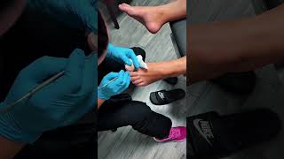 𝙋𝙧𝙚𝙘𝙞𝙨𝙞𝙤𝙣 𝘾𝙖𝙧𝙚 𝙛𝙤𝙧 𝙔𝙤𝙪𝙧 𝙏𝙤𝙪𝙜𝙝𝙚𝙨𝙩 𝙏𝙤𝙚 𝙋𝙖𝙞𝙣! #shorts #viral
