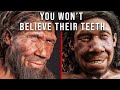 Why Cavemen Had Better Teeth Than You