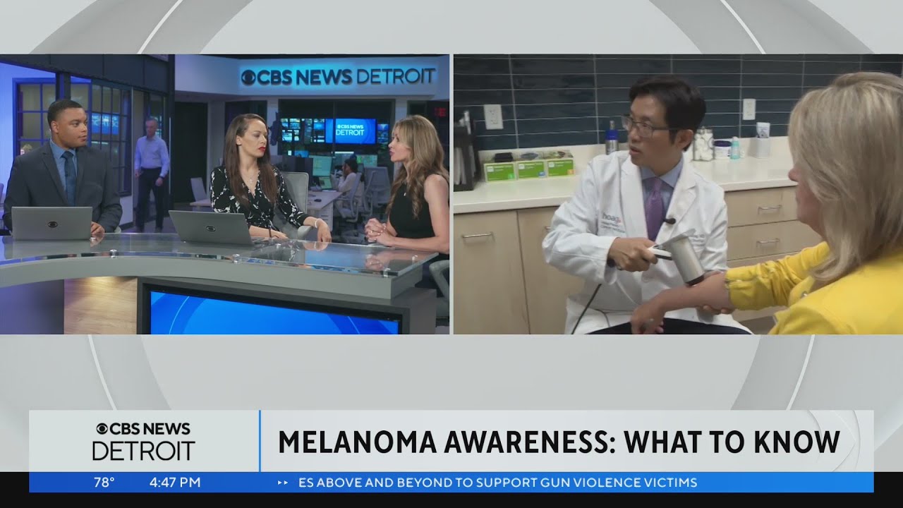 Melanoma awareness: What to know and what to look for