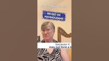 Kathy Shares Her Story with Lobular Breast Cancer