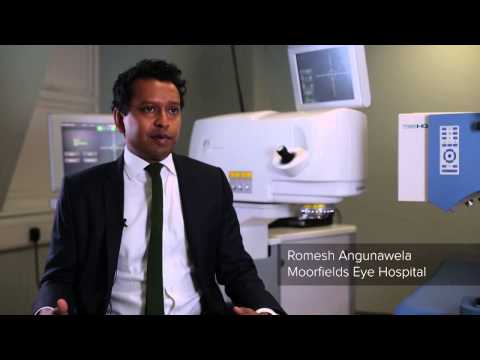 What Happens At The Consultation? | Lasik Eyes