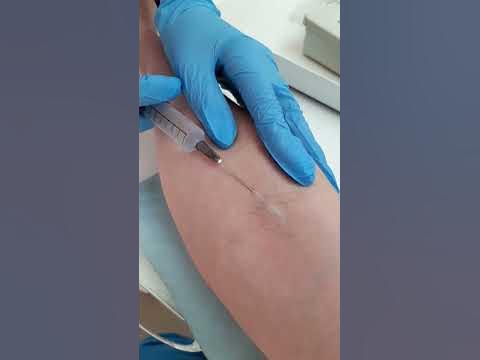 внутривенно первый раз, учимся. - YouTube