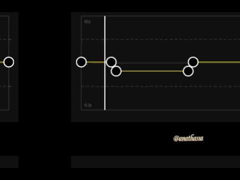 It's okay if you forget me - Astrid S - slowed down ver.  using cap cut app ( tiktok ) ♡