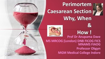 Perimortem Caeserean Section - Why ,When and How ! Obstetric Emergency