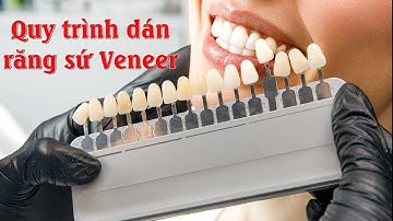 Quy trình dán sứ veneer | Quy trình bọc răng sứ | Quy trình làm răng sứ thẩm mỹ | Nha Khoa Uy Tín