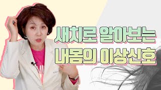 몸이보내는신호(8) 새치 : 새치가 알려주는 건강 적신호 4가지