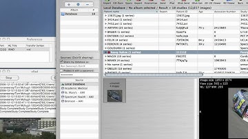ForeignCDImport - OsiriX