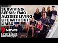 Surviving sepsis: Two Australians who lost their limbs to the deadly disease | Sunday Night