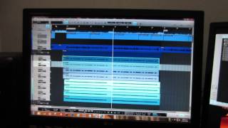 Nick Jonas - Chains Cover - Teaser