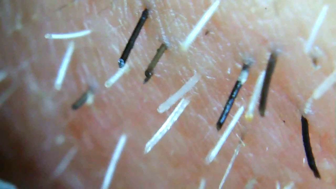 [plucking facial hair 12/15/21] YouTube