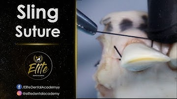 Sling Suture