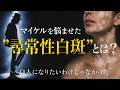 白人になりたいわけじゃなかった…　マイケルを悩ませた自己免疫疾患”尋常性白斑”とは？